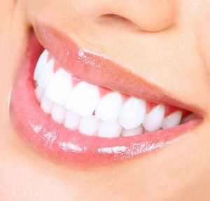 لبخندی زیبا با درمان به موقع دندان ها دندانپزشکی