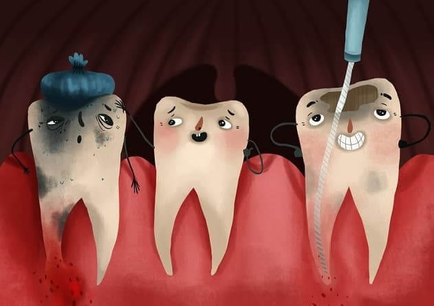هزینه عصب کشی دندان در کرج چقدر است؟