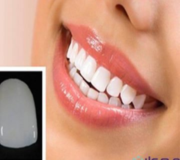 معرفی دندانپزشکی ارزان در فردیس