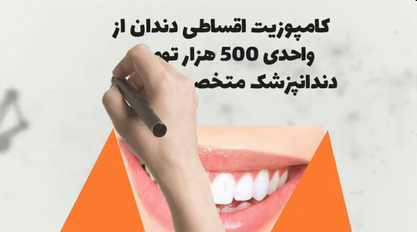 کامپوزیت اقساطی دندان