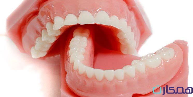 جدول قیمت دندان مصنوعی
