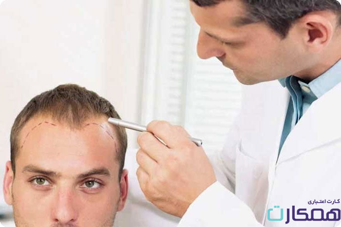 خدمات کاشت مو توسط بهترین پزشکان متخصص